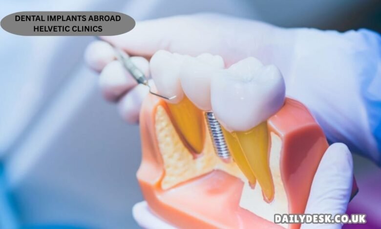dental implants abroad helvetic clinics